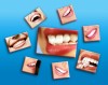 .Лазерное отбеливание зубов - подарите себе обаятельную улыбку!.